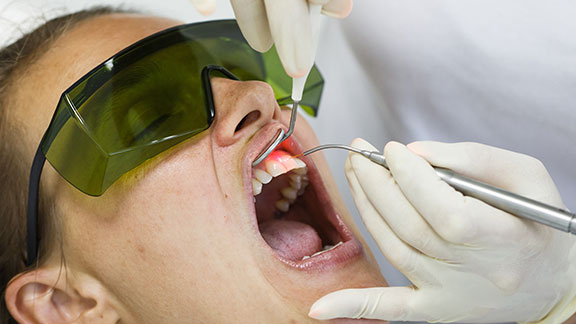 peri-implantitis laser treatment process gloucester ma