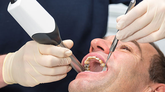 cerec same day crown process gloucester ma