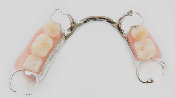 partial dentures example gloucester ma